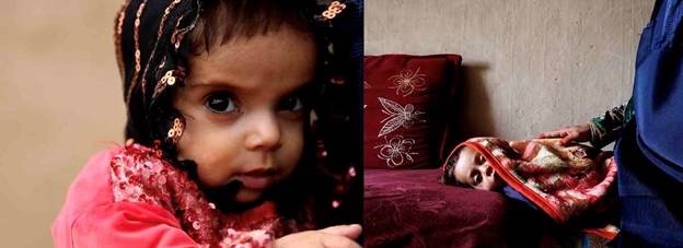 Desperate Afghan mother forced to give up one twin to feed the other as ...